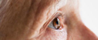 Glaucoma CME